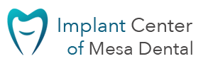 Implant-center-of-Mesa-Dental